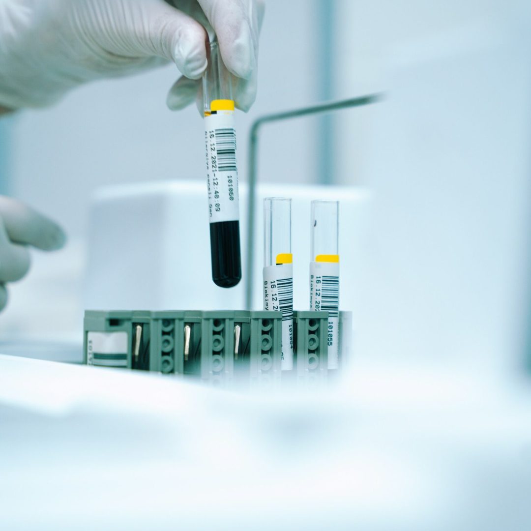 akram-huseyn-fKC9eWRnlGY-unsplash